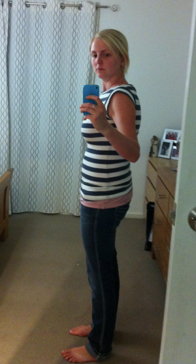 Fiona after weight loss