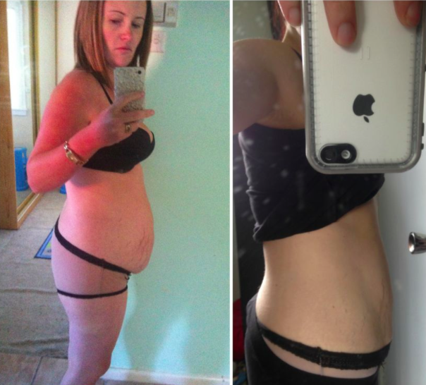 Belly Fat Be Gone - 101 On Tummy Fat - Lose Baby Weight