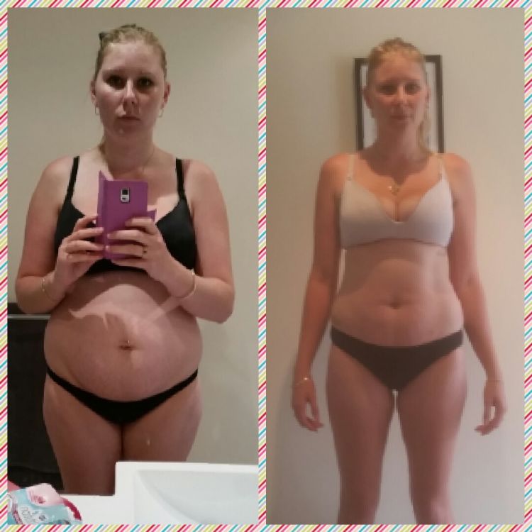 Lose Baby Weight- 10kg Loss 