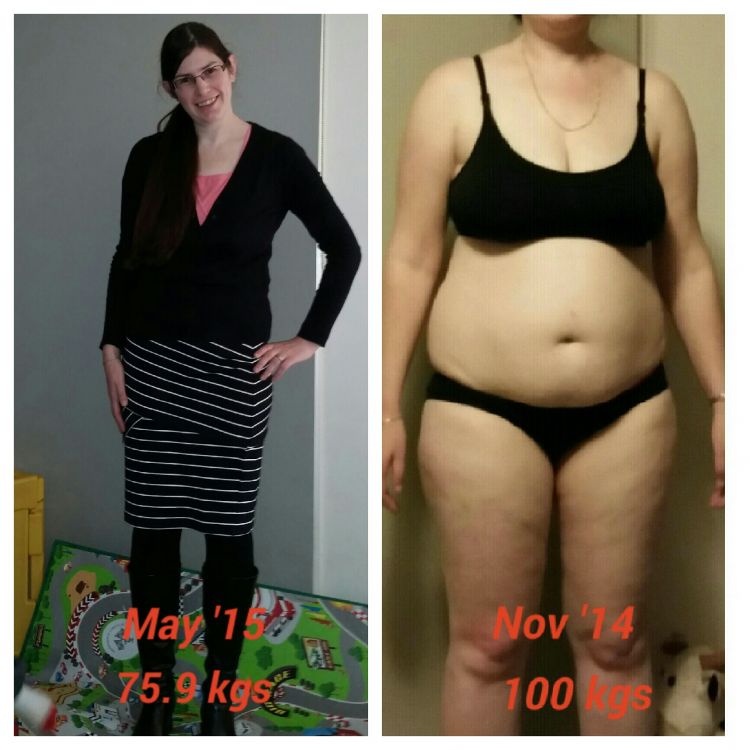 Lose Baby Weight-25kg Loss