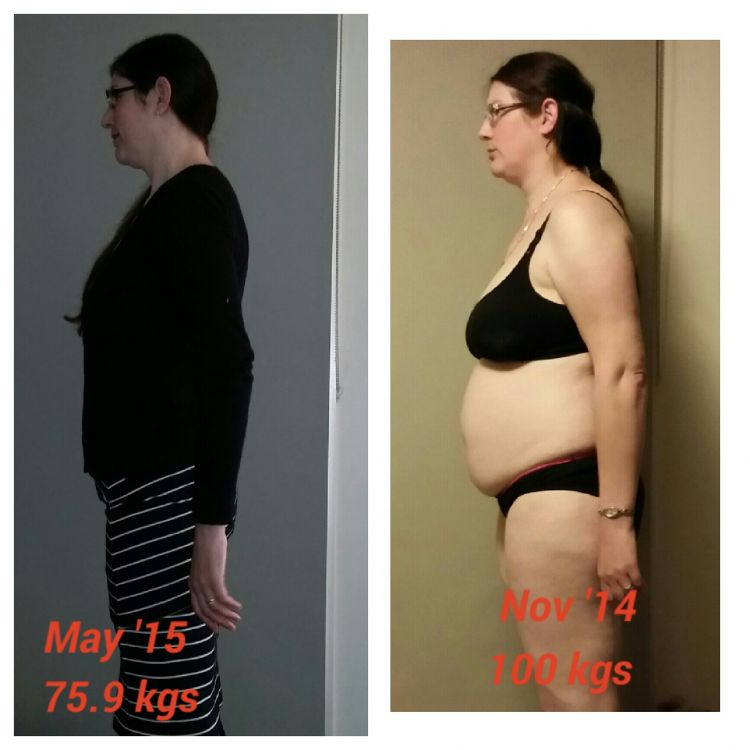 Lose Baby Weight-25kg Loss