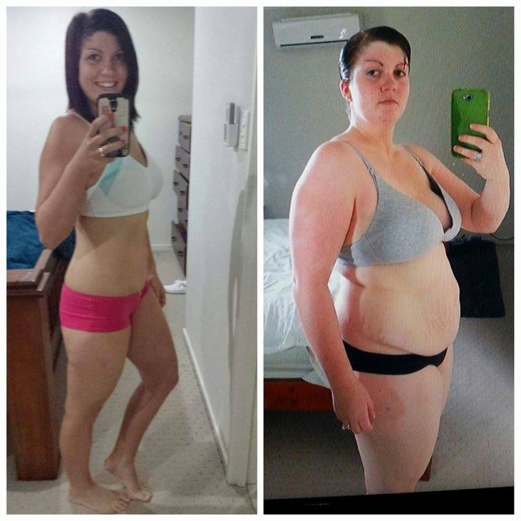Lose Baby Weight-26kg Loss