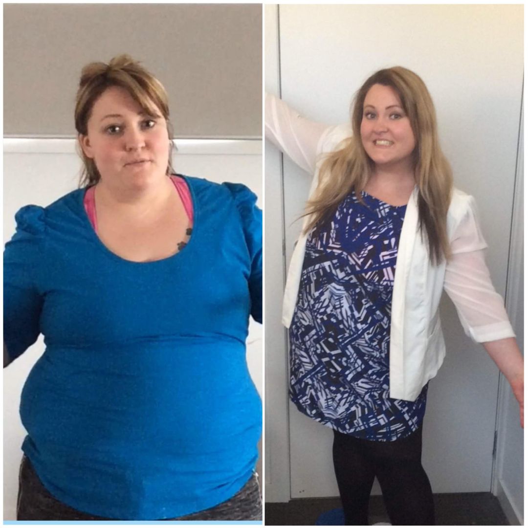Lose Baby Weight- 25kg Loss