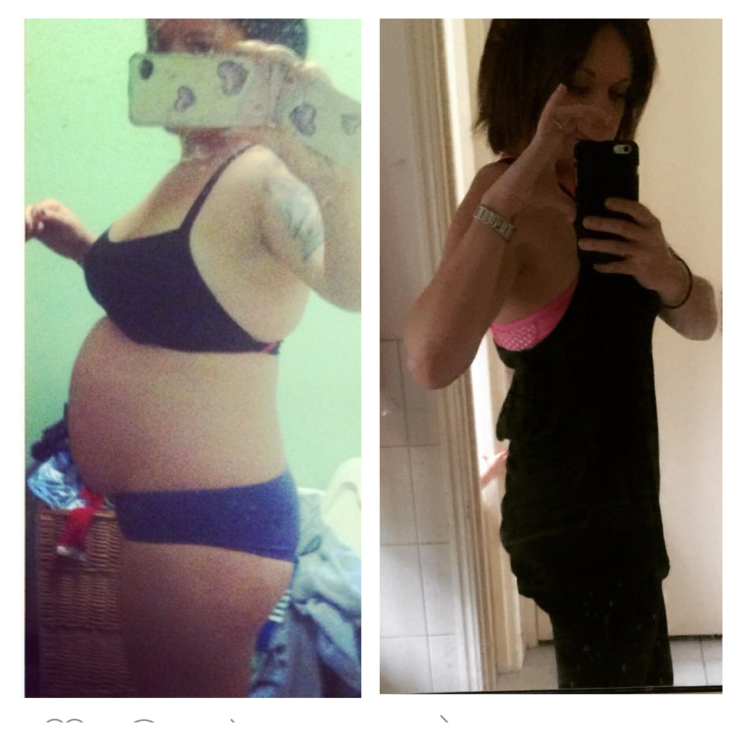 Lose Baby Wwight-20kg Loss