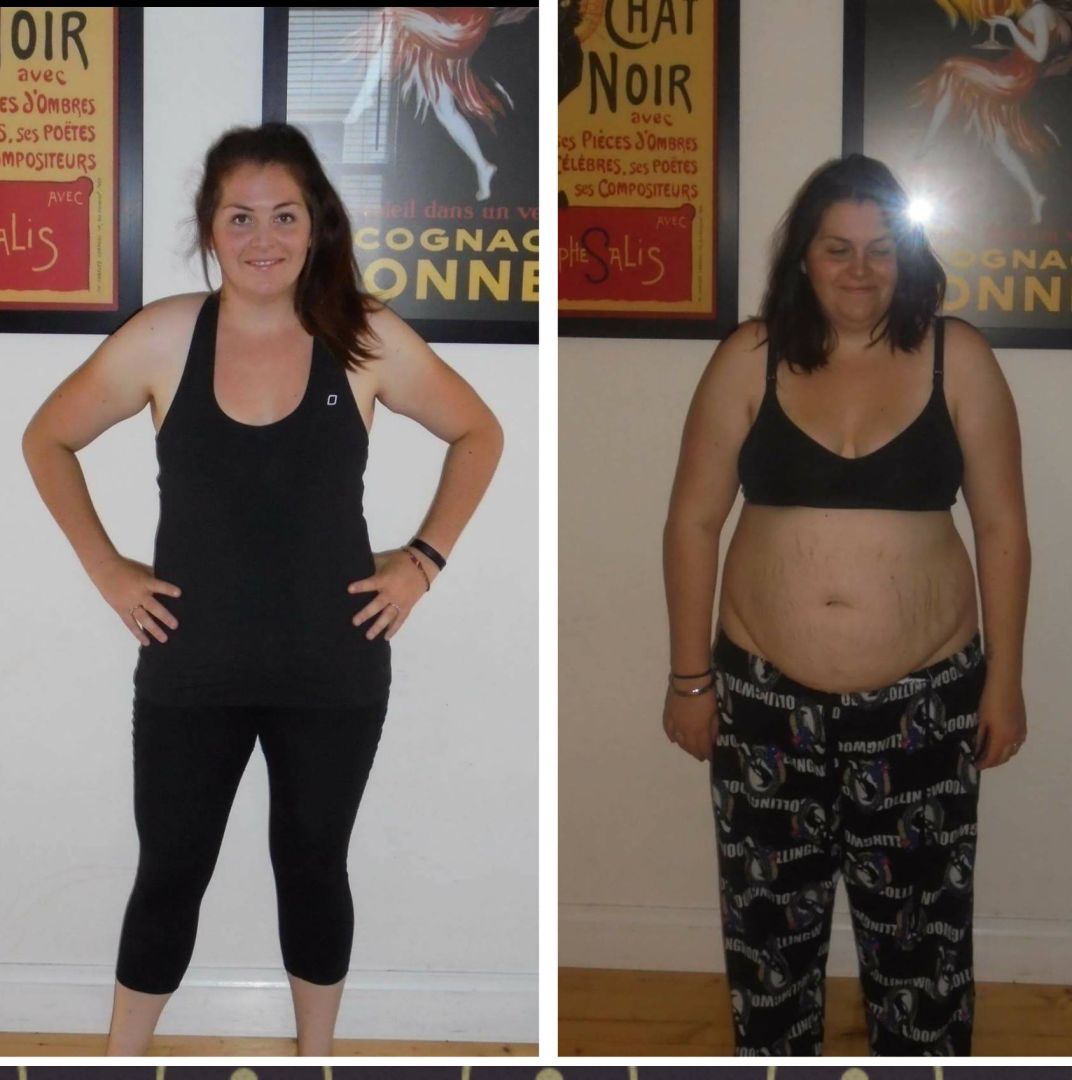 Lose Baby Weight - 20kg Loss