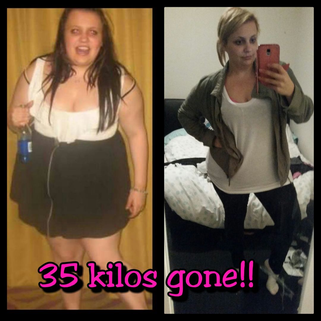 Lose Baby Weight 35kg Loss