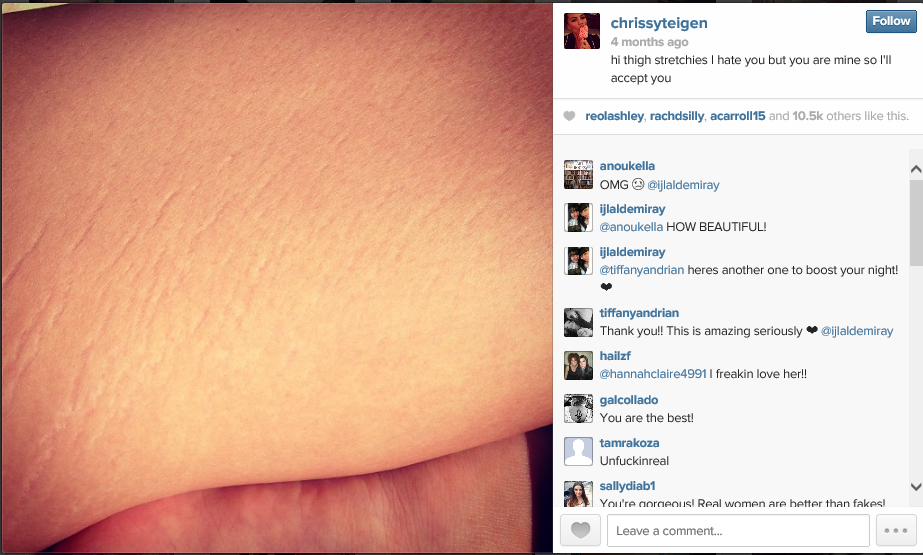 chrissy teigen shows off post baby cellulite